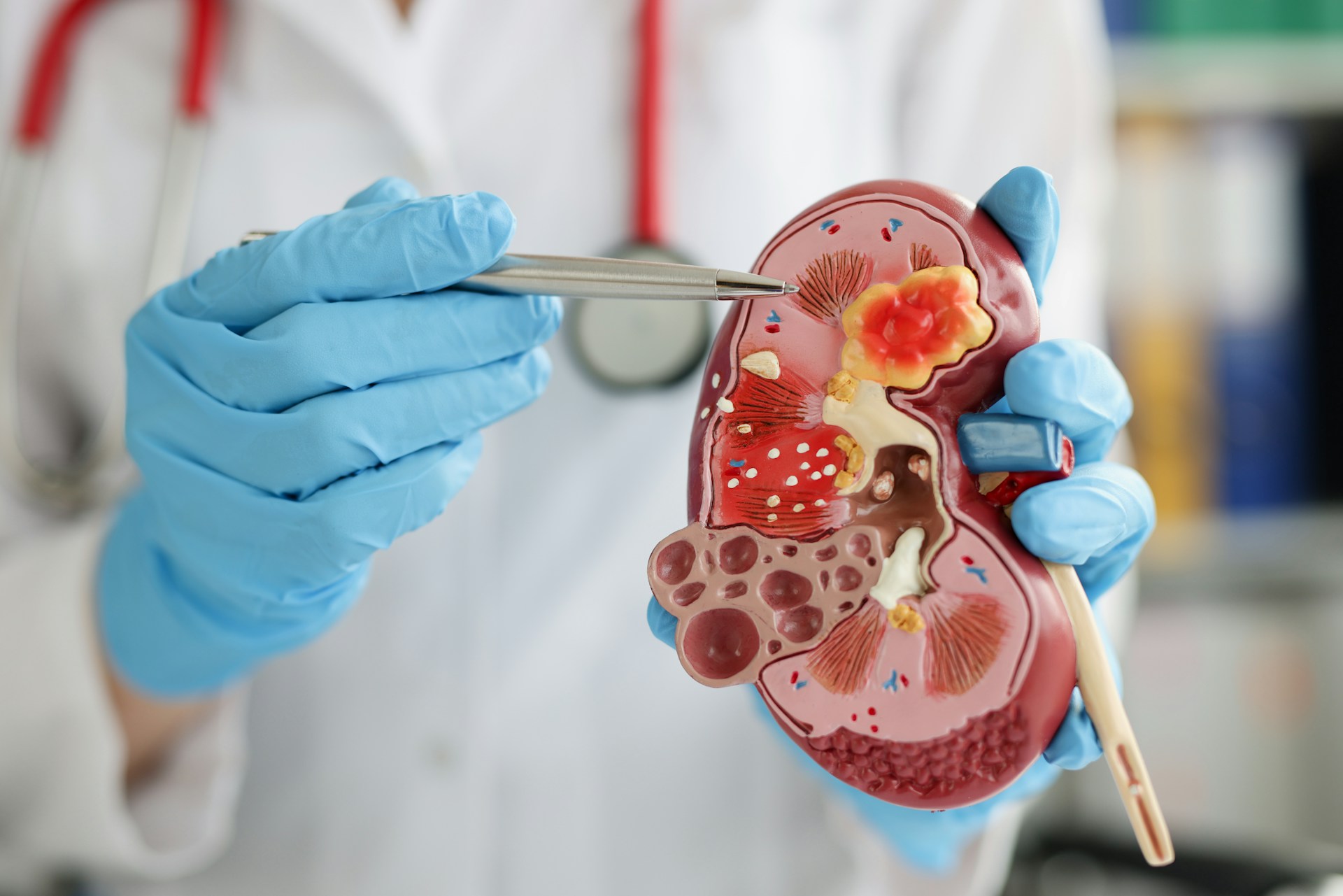Mortality Reduction in Diabetics with PDE5 Inhibitor, Statin, and Testosterone Combination