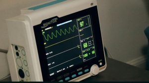 Photo of a cardiac monitor showing blood pressure and pulse measurements.