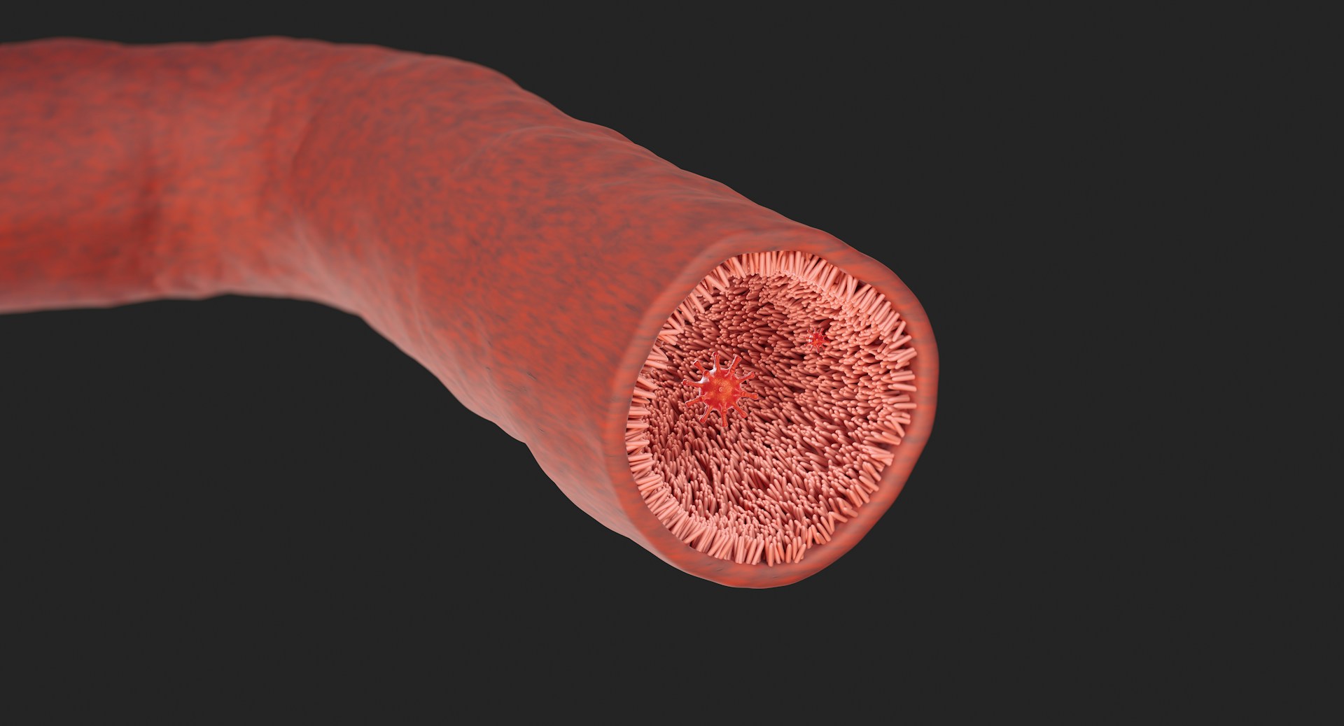 Vascular Fluorosis: A Hidden Threat in the Water Supply